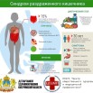 Синдром раздраженного кишечника.jpg