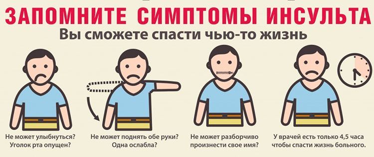 simptomy-insulta.jpg