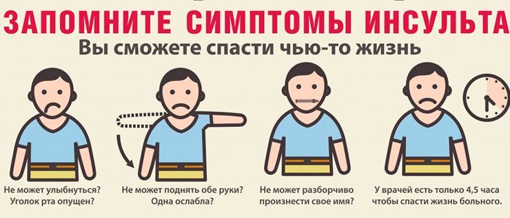 simptomy-insulta.jpg